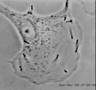 Listeria monocytogenes - YouTube