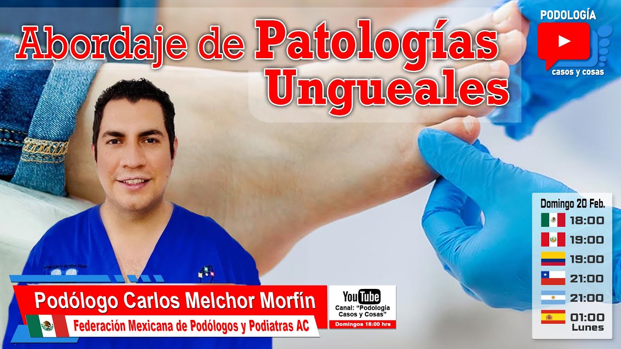 ABORDAJE DE PATOLOGÍAS UNGUEALES | Podólogo Carlos Melchor Morfín | Podología Casos y Cosas