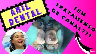 Amil Dental tem Tratamento de Canal??? O convenio odontologico cobre tratamento de canal?