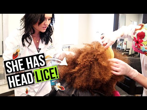 Lice and Nits in African American Hair! How to Remove Lice from a Big Beautiful Afro