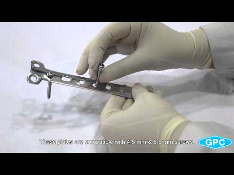Part of a video titled Orthopedic 3.5mm T Plates (Stainless Steel), T Plates for 4.5mm Screws