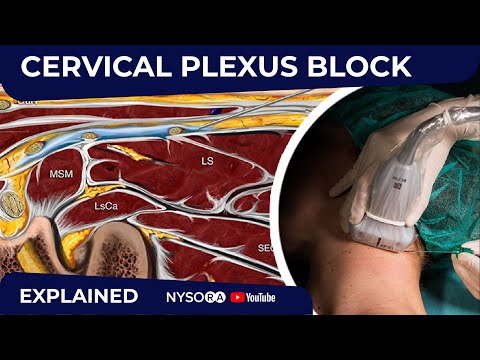 Cervical Plexus Block - Regional anesthesia Crash course with Dr. Hadzic
