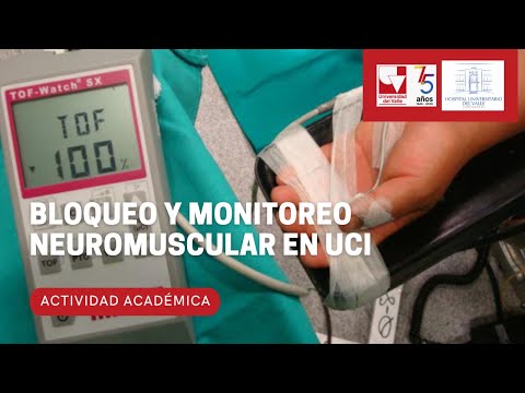 Bloqueo y monitoreo neuromuscular en UCI