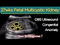 27wks Fetal Multicystic Kidney - OBS Ultrasound Congenital Anomalies