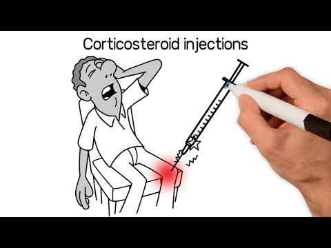 Knee Osteoarthritis Cortisone Steroid Injections; NYC Dr.