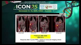 FAP-based radiotheranostics (FRT) for the treatment of diverse adenocarcinomas and sarcoma Pr BAUM