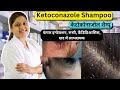 Treatment Of Dandruff Ketoconazole Shampoo Ketoconazole Shampoo Uses In Hindi