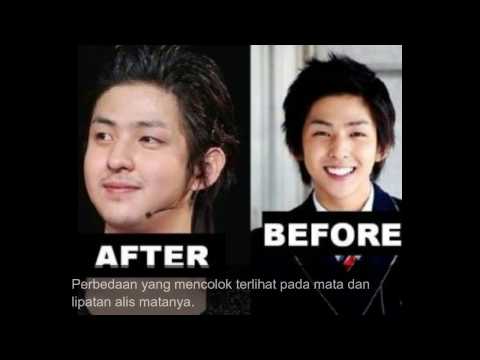 Dan pil potensi Tabeks Obat modern untuk impotensi