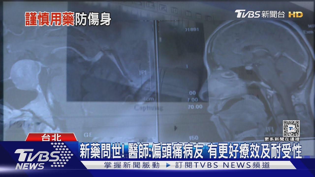 頭痛嚴重才吃藥 藥效打折扣 醫師:掌握這原則 能有效緩解疼痛!