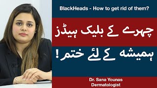 How To Get Rid of Blackheads/Whiteheads | Blackheads And WhiteheadsTreatment | Dr. Sana Younas