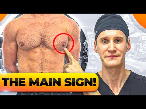 Do You Really Have Gynecomastia? (Home Test)