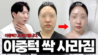 늘어진 투턱, 이렇게 관리해보세요✔️