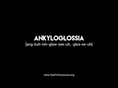 How to Pronounce "ankyloglossia"