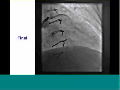 VA CTO Club 15 - December 17 2014