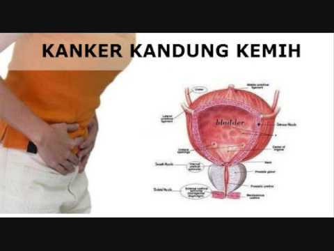 Latihan yoga untuk meningkatkan potensi Bagaimana patogen kuda menonton video