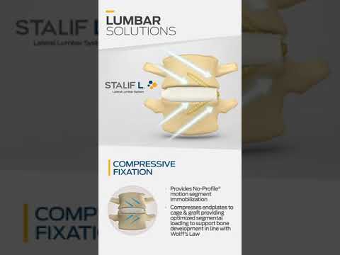 Centinel Spine Lumbar Product Portfolio 2017 Animation