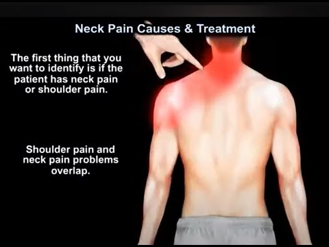 Causas y tratamiento del dolor de cuello