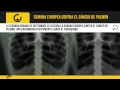 Semana europea contra el cáncer de pulmón