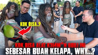 Download lagu Goosebumps!! How can this dreadlocked man with mental disorders be as big as a coconut? mp3 Download lagu Goosebumps!! How can this dreadlocked man with mental disorders be as big as a coconut? mp3