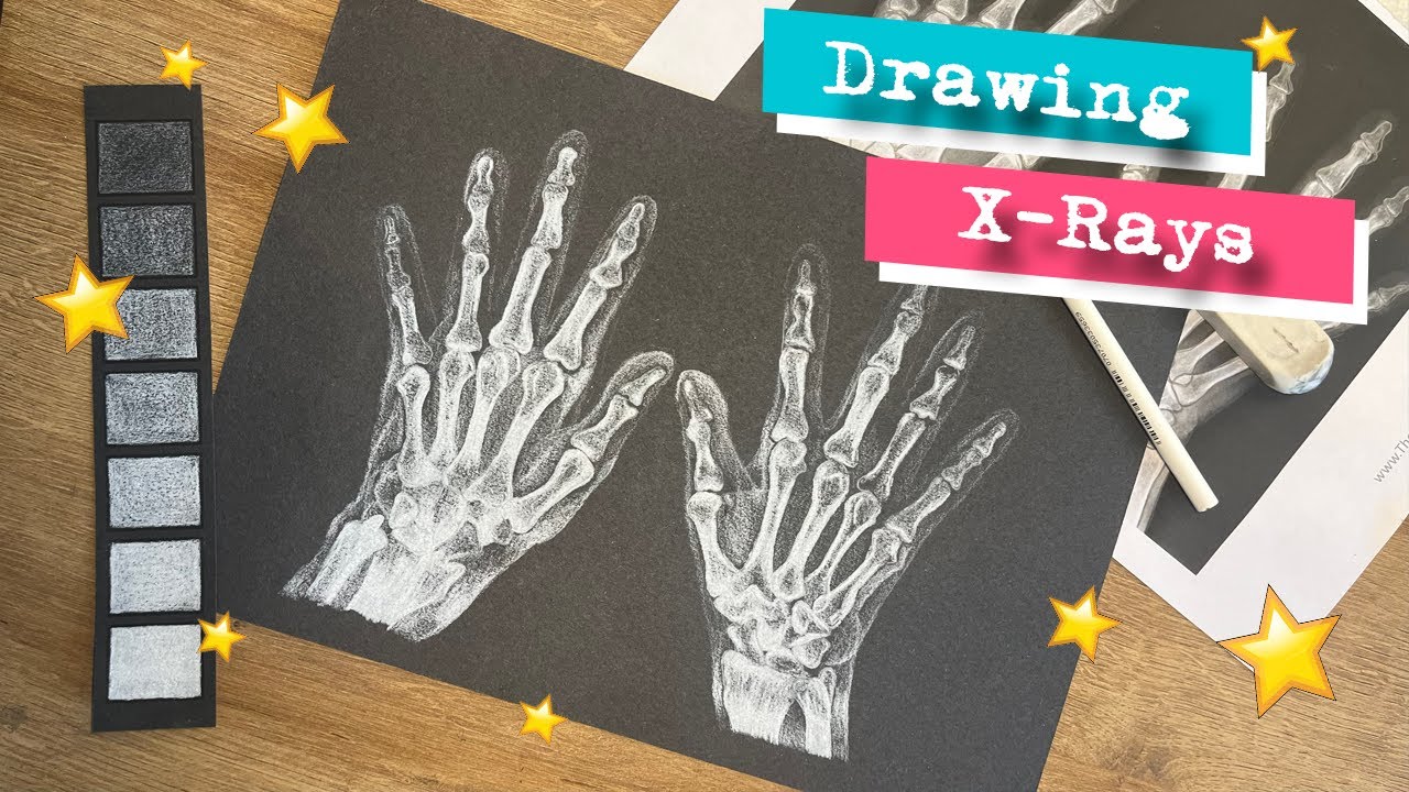 Drawing X-Rays