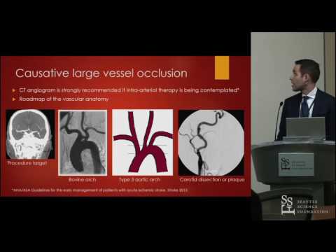 Stroke Interventions - Dustin Hayward, MD