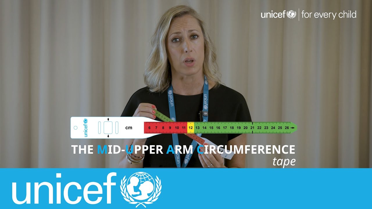 A simple tool to detect severe malnutrition: the MUAC tape and the Mother-infant MUAC tape