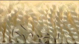 Why We Recommend Flea/Tick Treatment YEAR ROUND
