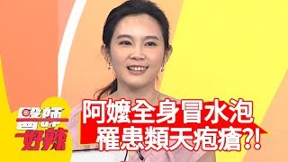 70歲阿嬤全身冒水泡，竟是罹患「類天疱瘡」？醫生：中風、失智者好發性高！【醫師好辣】 20190919 part3 EP813 田知學 張振榕