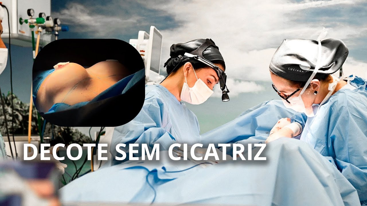 MASTOPEXIA EM L SEM PRÓTESES - VEJA O RESULTADO!