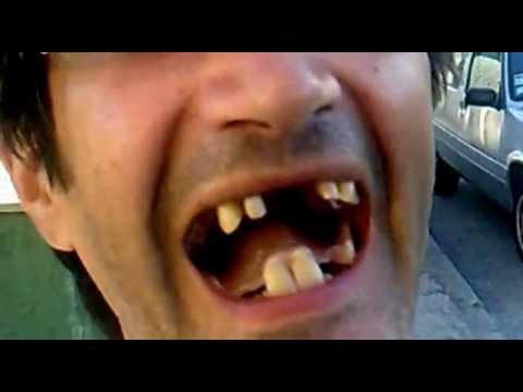 homem mais feio de ovar