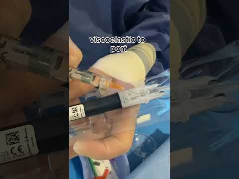 PureSee extended range toric lens in the house!