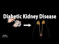Diabetic Kidney Disease, Animation