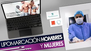 Definición abdominal - Lipomarcacion Hombres  y Mujeres Dr.Gerardo Camacho Cirujano Plastico - Dr. Gerardo Camacho