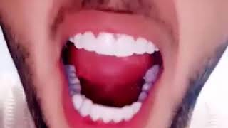فك واحد ب 400 درهم و 700 درهم فقط للفكين معا عرض خاص ومحدود إلى غاية 19 يوليوز 2019