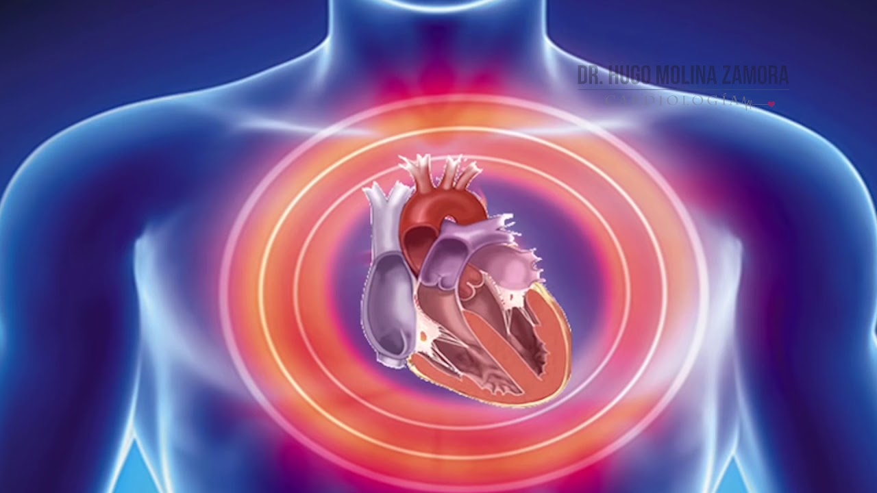 Hugo Molina Zamora-8