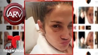 JLo termina con un ojo morado y mira por qué | Al Rojo Vivo