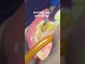 Scaling And Polishing Routinedentaltreatment Scaling Polishing Whitening Dentist