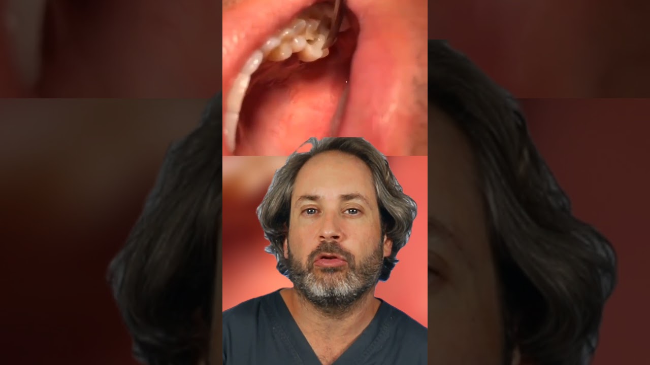 MUCHO CUIDADO si se te rompe UN POCO tu diente puede indicar algo MUY GRAVE  #shorts