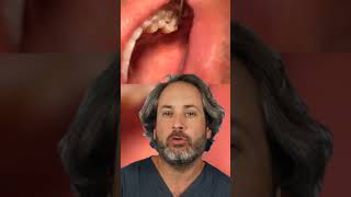 MUCHO CUIDADO si se te rompe UN POCO tu diente puede indicar algo MUY GRAVE  #shorts