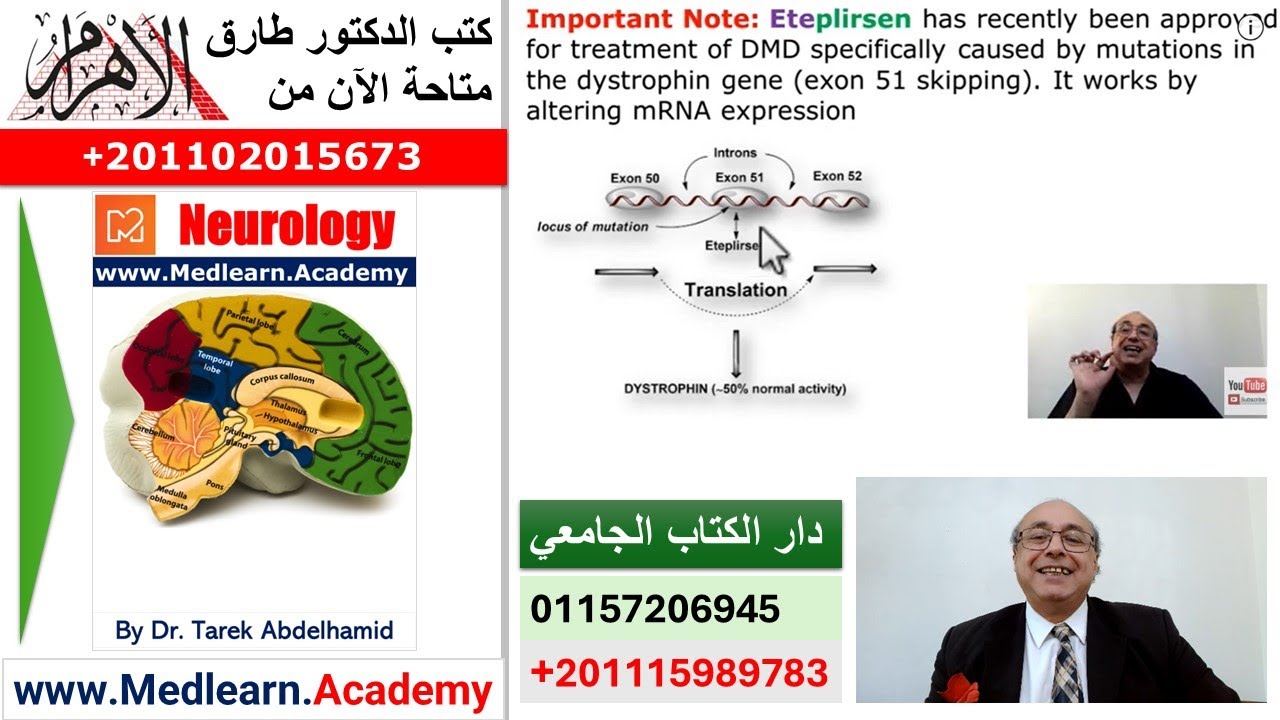 Duchenne muscular dystrophy DMD (2)  #CME #internal_medicine #usmle   #محاضرات_باطنة