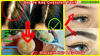 SARIMSAK KREMİNİ SÜRDÜ,SAÇLARI ve KAŞLARI YENİDEN ÇIKTI.SAÇ - KAŞ ÇIKARAN MUCİZE TARİF #EyebrowSerum