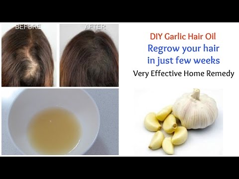 Incredible Benefits Of Garlic For Hair Incredible Benefits Of Garlic For Hair