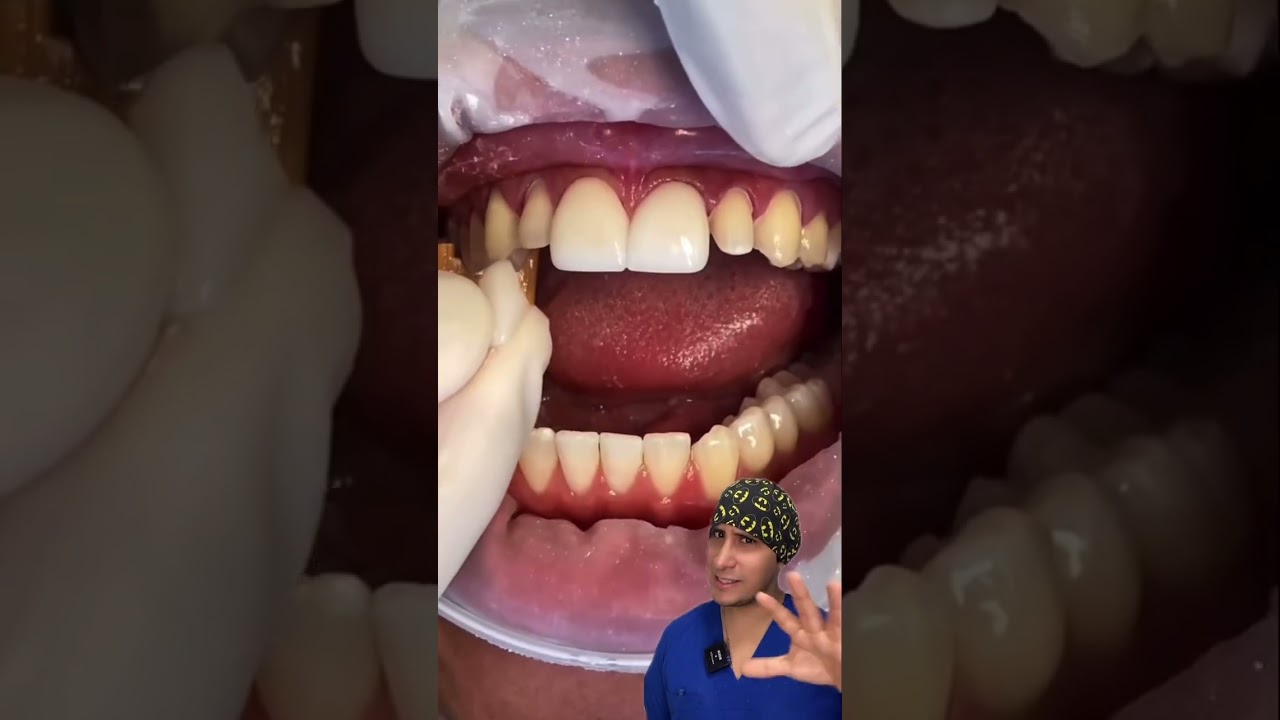 Jose David Torres Hernandez-39