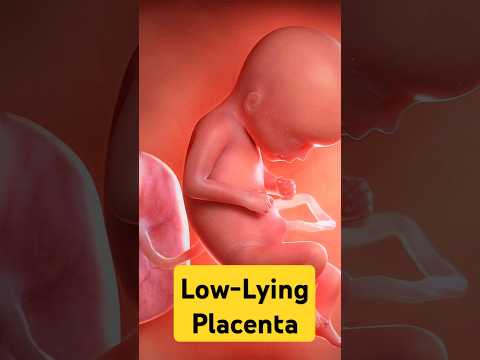 Low-Lying Placenta Explained | Causes, Precautions & Tips | Dr.Roopa Ghanta | Little Stars & She