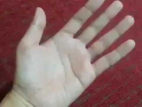 รักษาดิน neurodermatitis เมล็ดฟักทองน้ำมันการจัดอันดับของโรคสะเก็ดเงิน