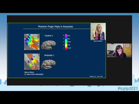 ICPLP2021 - Prof. Makin: Stability of sensory topographies in amputees