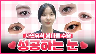 절개 없이 예쁜 눈! 자연유착 쌍수의 모든 것