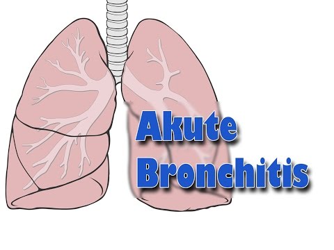 Akute Bronchitis | Erkrankungen der Atemwege | Pflege Kanal