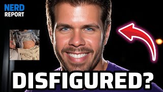 PEREZ HILTON SHOCKING UPDATE After Livestream Incident — Possible Permanent Disfigurement!