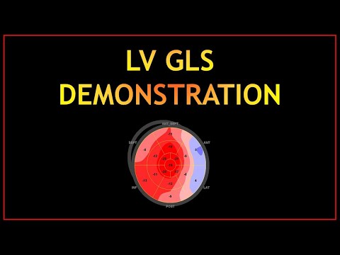 GLS Practical Demonstration! (PART 2)